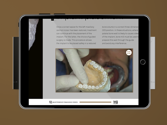 Quintessence The big Picture iPad  Screenshots