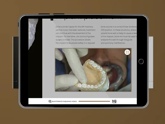 Screenshot di Quintessence The big Picture iPad 