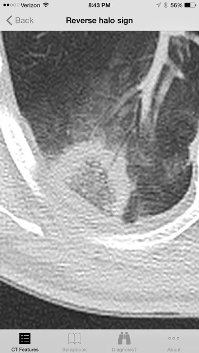 Ảnh chụp màn hình của Lung CT Field Guide