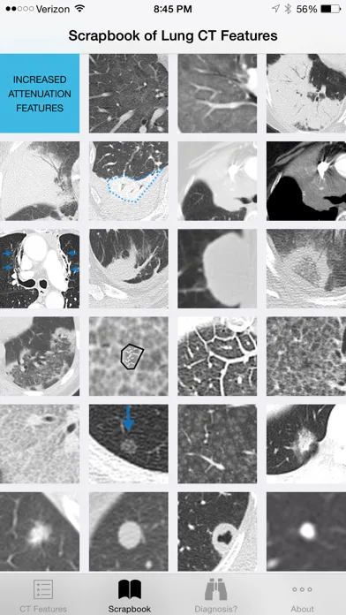 Ảnh chụp màn hình của Lung CT Field Guide