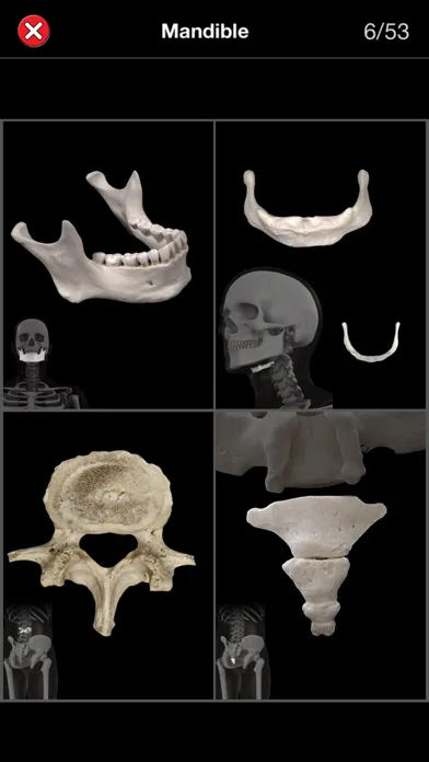 Скриншоты Anatomy Quiz Pro