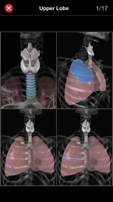 Скриншоты Anatomy Quiz Pro