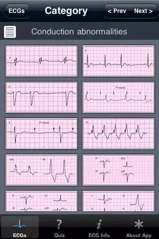 Capturas de pantalla de ECG Pocket Reference Free