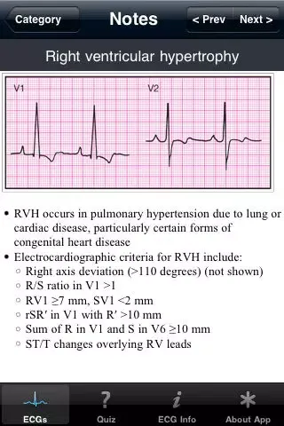 Capturas de pantalla de ECG Pocket Reference Free