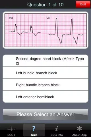 Capturas de pantalla de ECG Pocket Reference Free