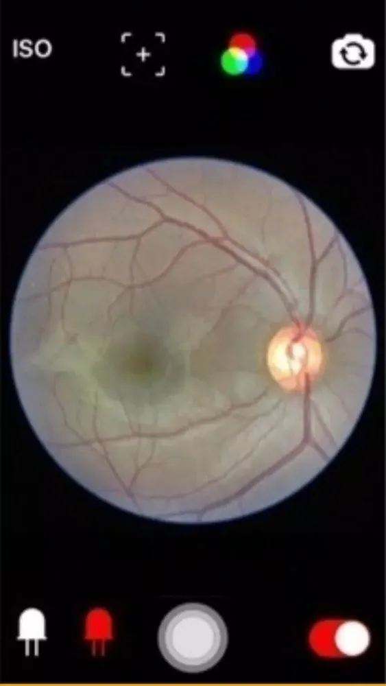 Fundus Cam应用截图