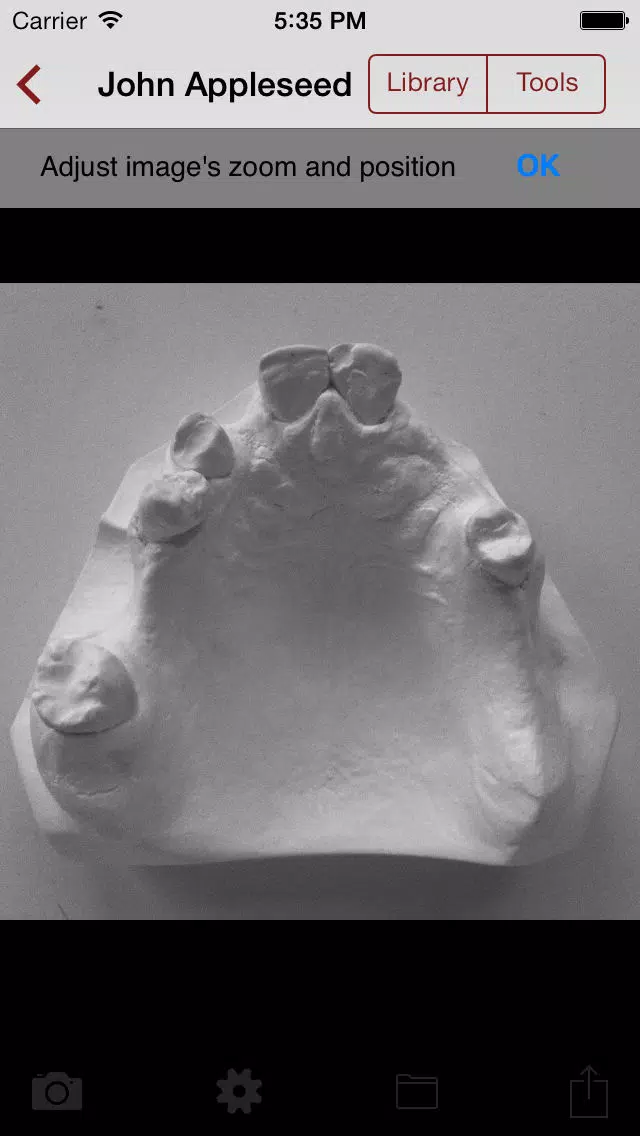 DentALL Removable Partial Denture Designer Screenshots