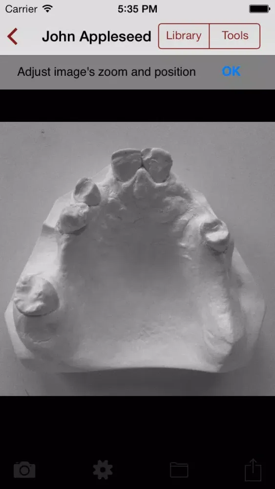 DentALL Removable Partial Denture Designer Screenshots