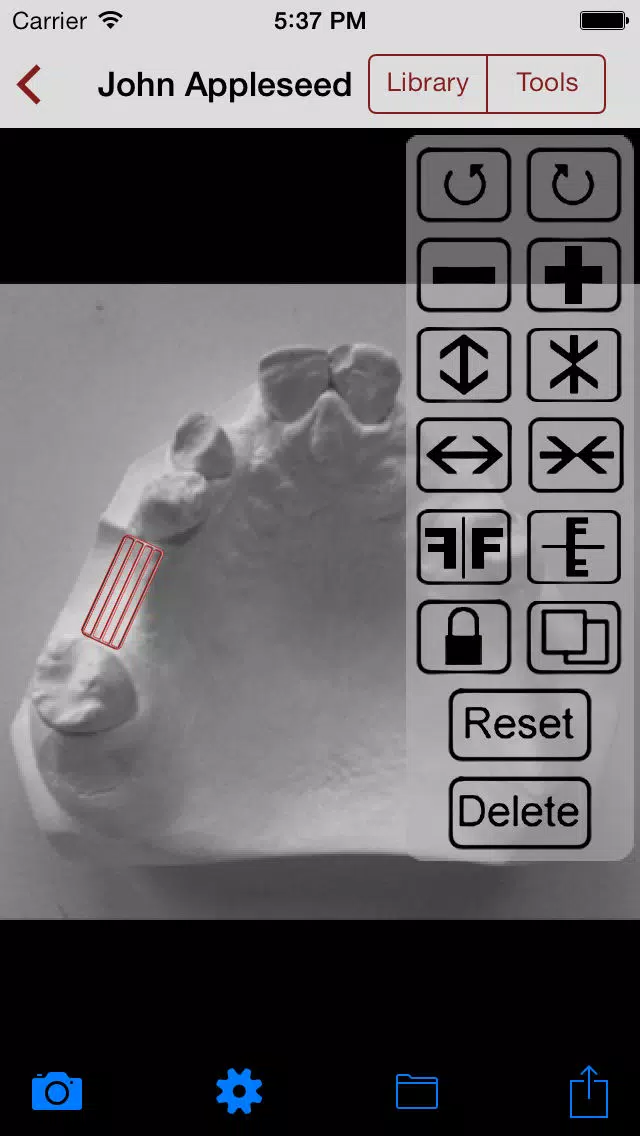DentALL Removable Partial Denture Designer Screenshots