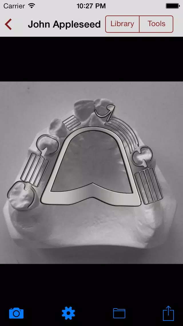 DentALL Removable Partial Denture Designer Screenshots
