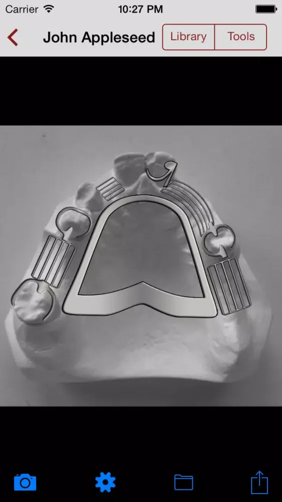 DentALL Removable Partial Denture Designer Screenshots