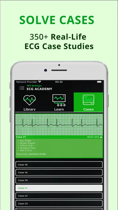 ECG Academy - Learn EKG Skills スクリーンショット