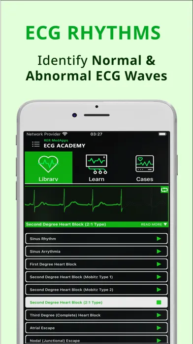 ECG Academy - Learn EKG Skills スクリーンショット
