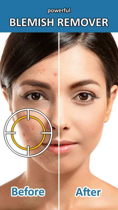 Blemish Remover Photo Tool スクリーンショット