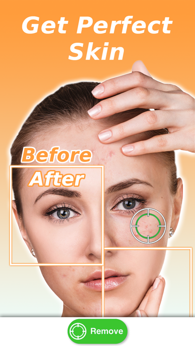 Tangkapan layar Perfect Smile: Teeth Whitening