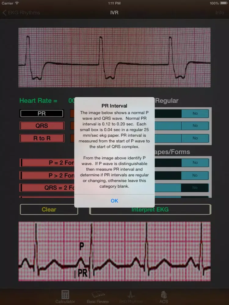 صور EKG Calculator iPad
