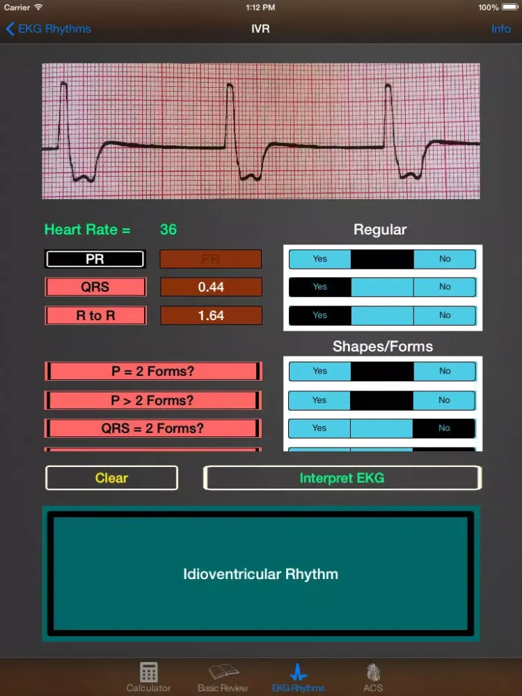 صور EKG Calculator iPad