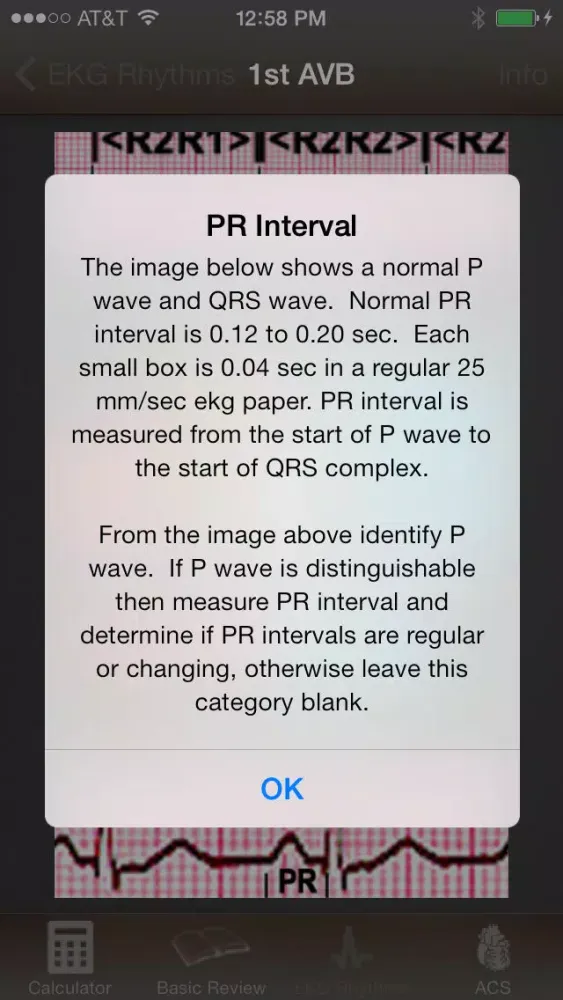 صور EKG Calculator