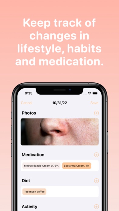 Rosacea Diary 스크린샷