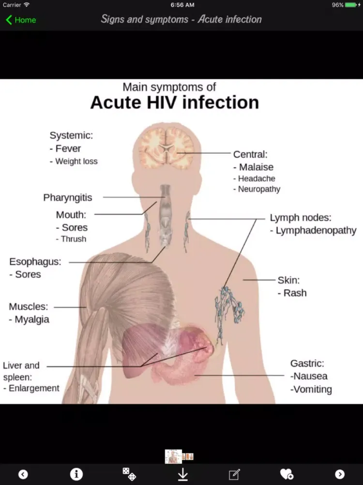HIV-AIDS Guide iPad  سکرین شاٹس