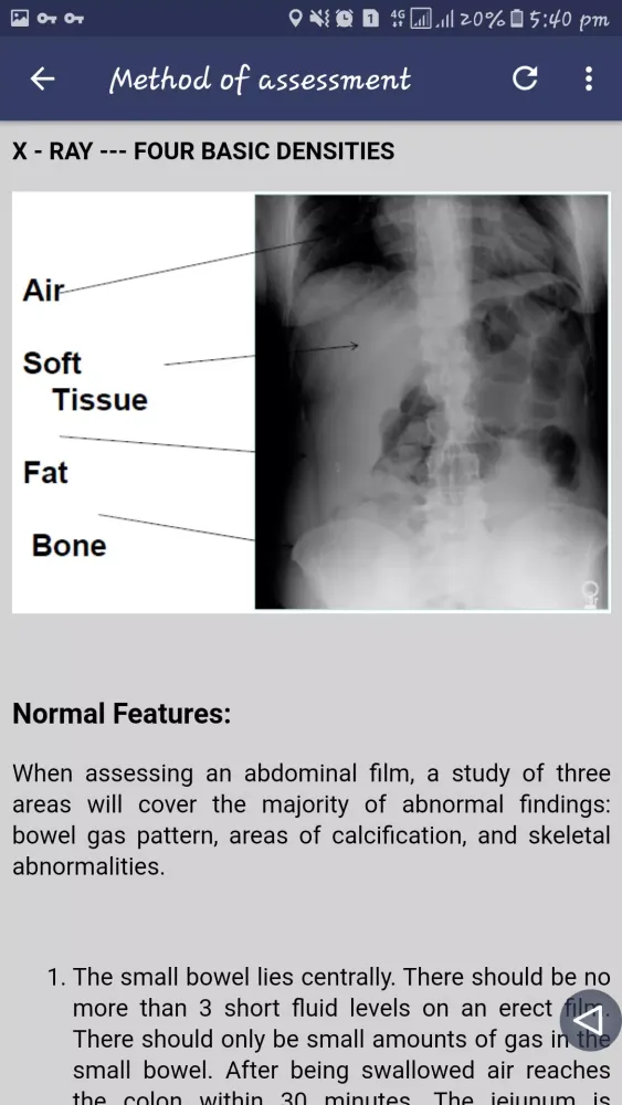 Abdominal X-ray Screenshots