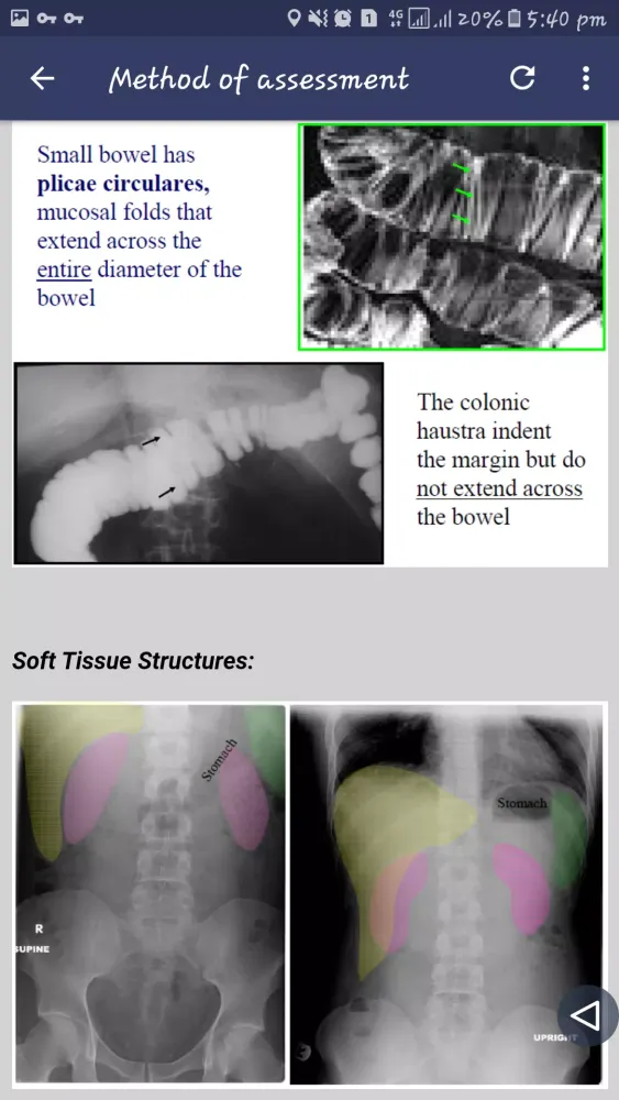 Abdominal X-ray Screenshots