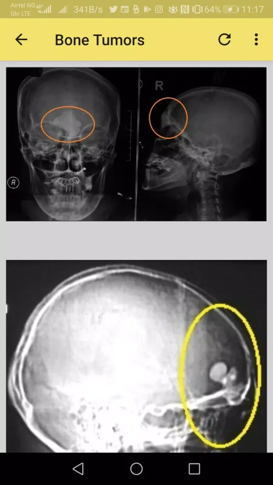 Capturas de pantalla de Musculoskeletal X-ray App