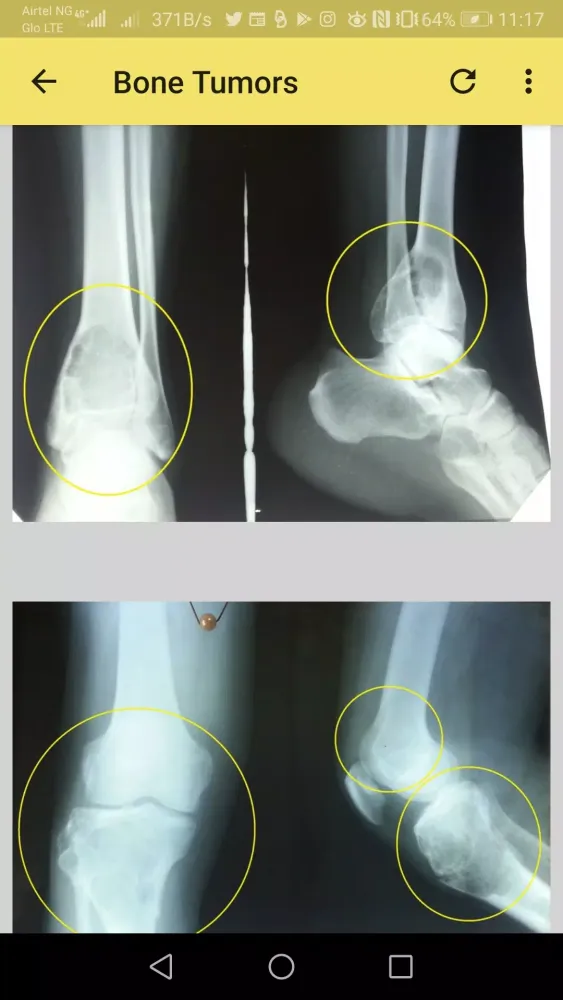 Capturas de pantalla de Musculoskeletal X-ray App