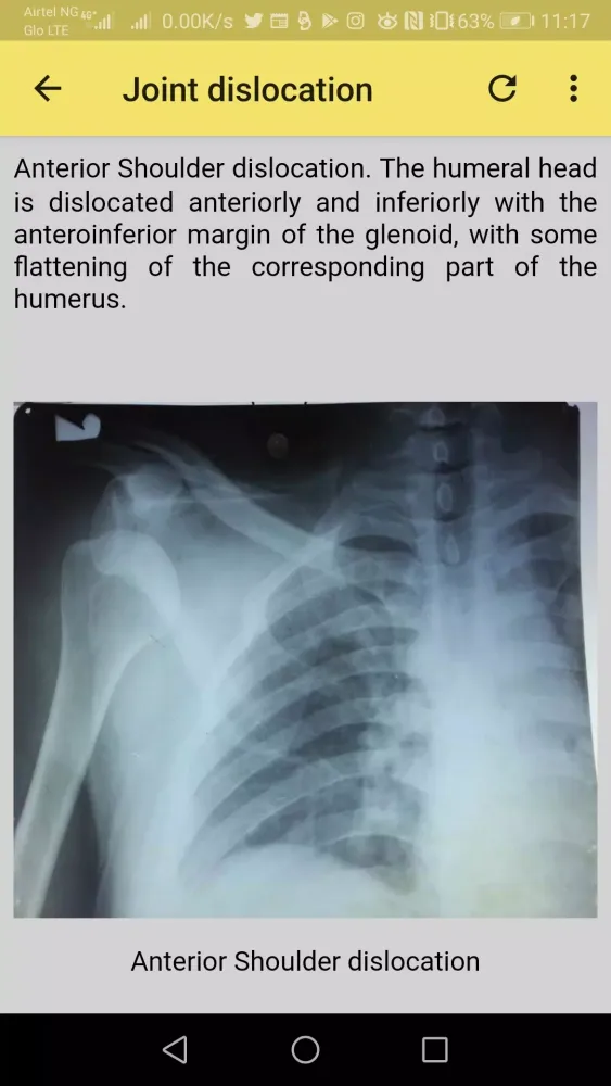Capturas de pantalla de Musculoskeletal X-ray App
