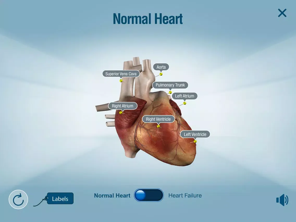 HeartMate 3™ LVAD AR app iPad  स्क्रीनशॉट