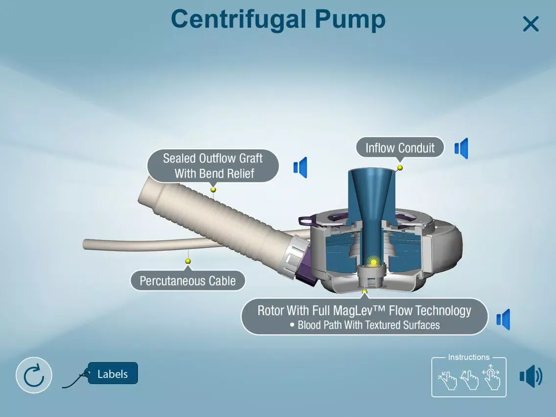 HeartMate 3™ LVAD AR app iPad  स्क्रीनशॉट