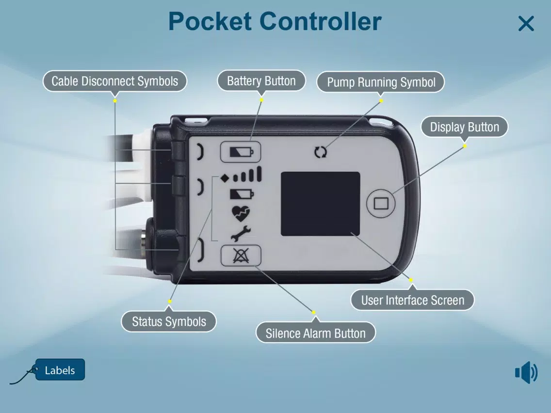Ảnh chụp màn hình của HeartMate 3™ LVAD AR app iPad 