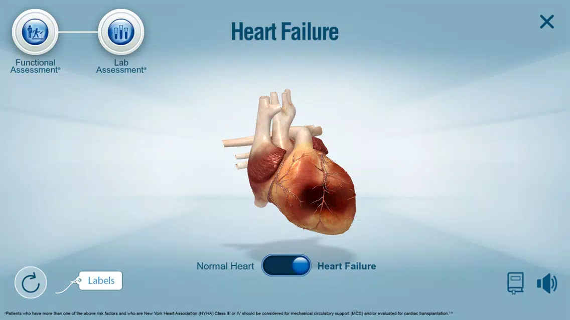 Ảnh chụp màn hình của HeartMate 3™ LVAD AR app