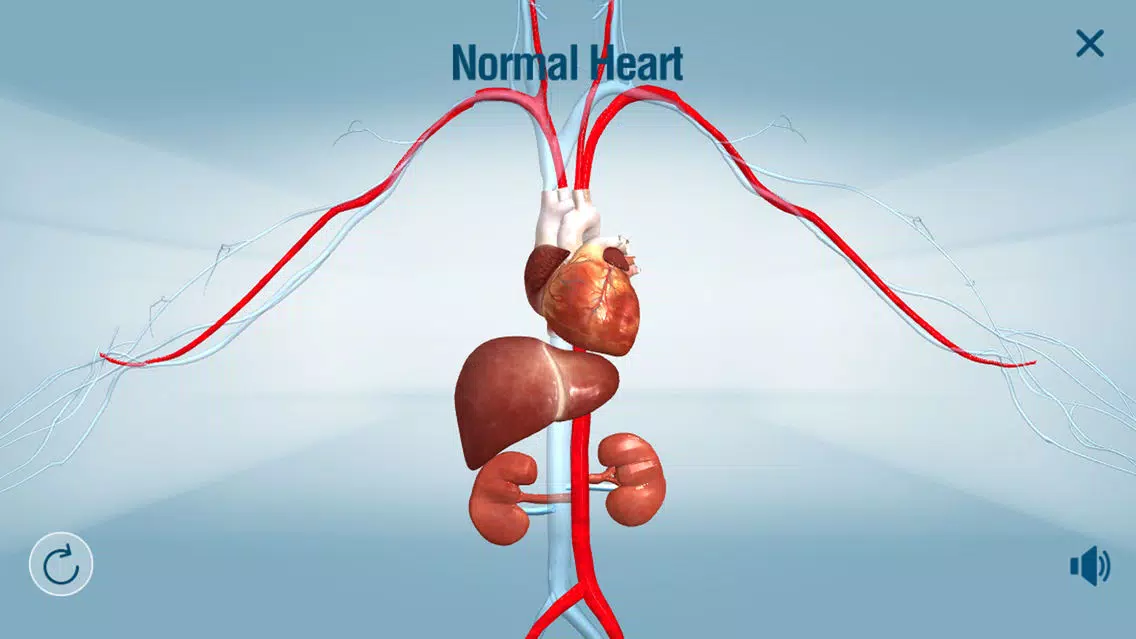 Ảnh chụp màn hình của HeartMate 3™ LVAD AR app