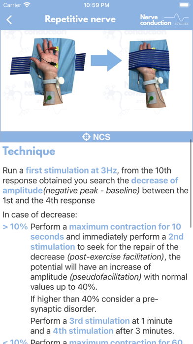 صور Nerve Conduction Studies