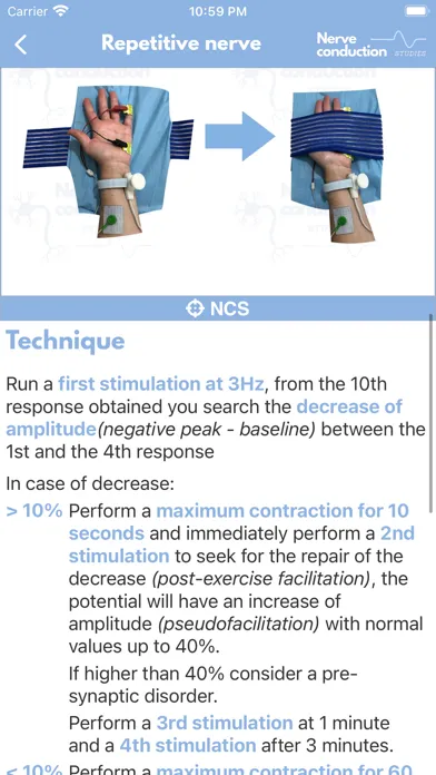 Nerve Conduction Studies سکرین شاٹس