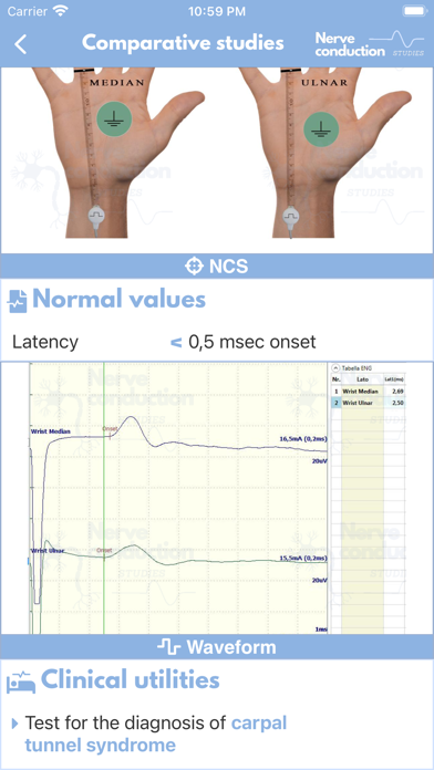 صور Nerve Conduction Studies