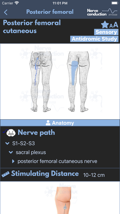 صور Nerve Conduction Studies