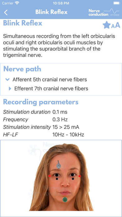 صور Nerve Conduction Studies