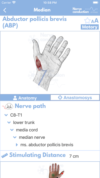 صور Nerve Conduction Studies