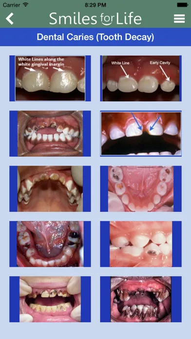 Smiles For Life Oral Health应用截图