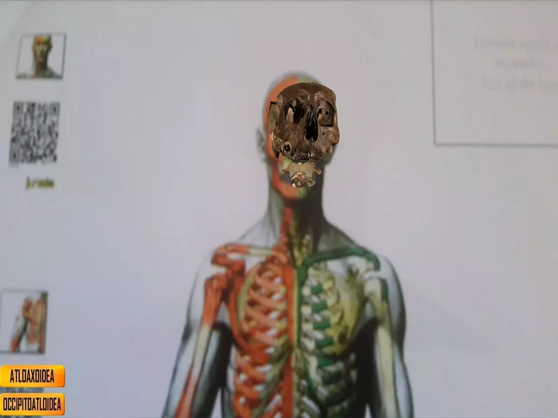 Cervical iPad  스크린샷