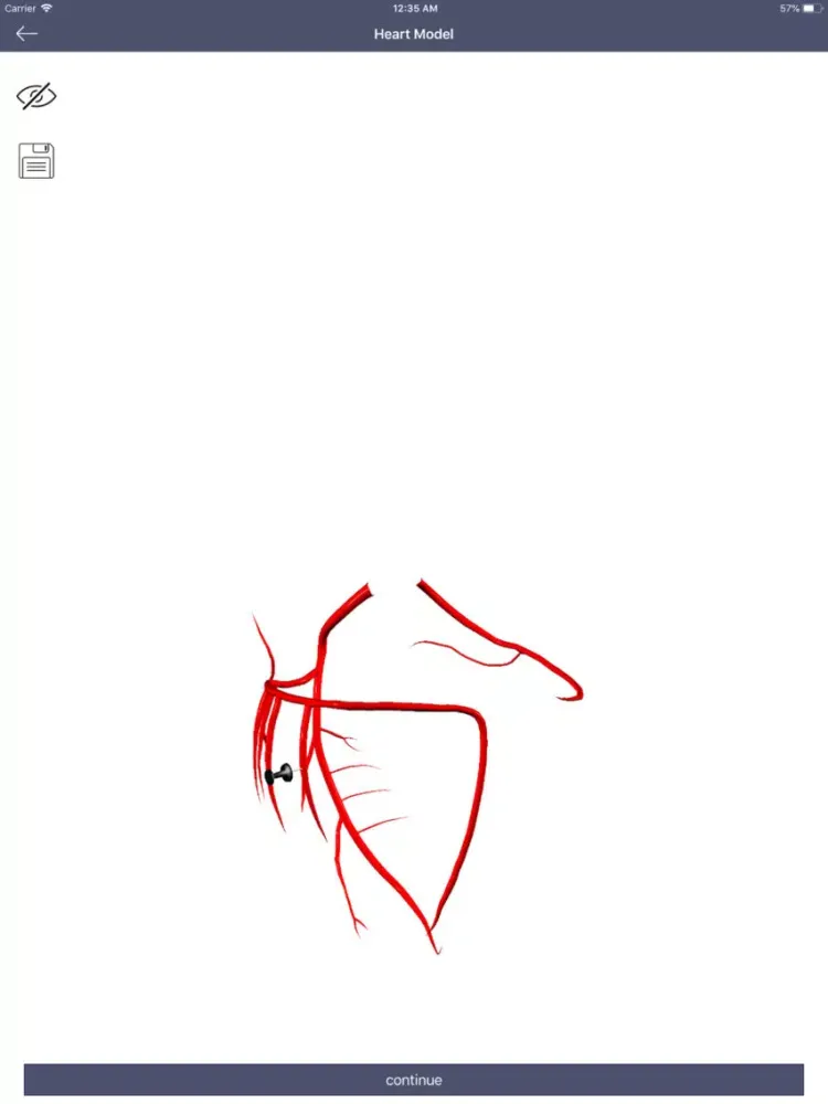 C-Angio iPad 應用截圖