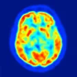 Neurosurgery: What's the data?