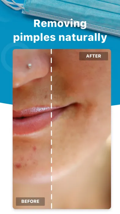 Tangkapan skrin Blemish Editor - Face Tuner
