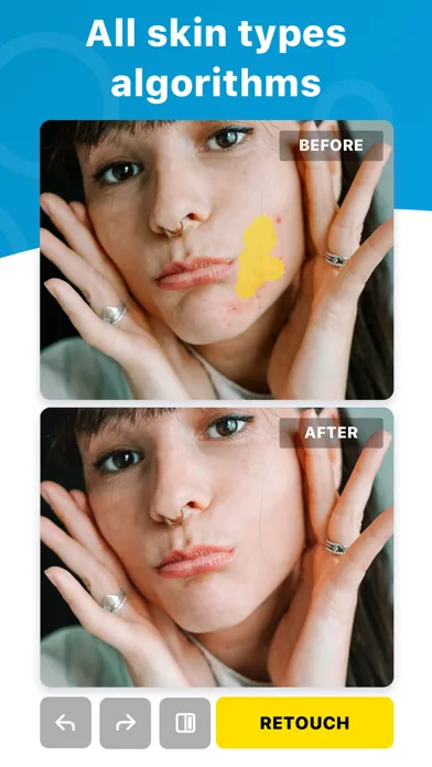Tangkapan skrin Blemish Editor - Face Tuner