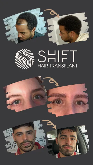 SHIFT Hair Transplant स्क्रीनशॉट