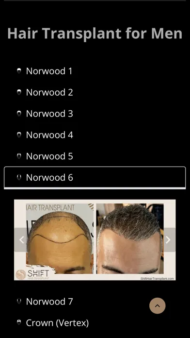SHIFT Hair Transplant स्क्रीनशॉट