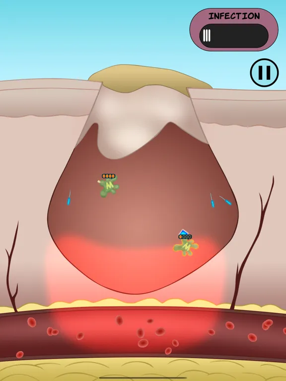 Скриншоты Dermis Defense iPad 