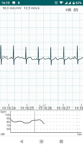 ภาพหน้าจอของ DiaCard - ECG Recorder